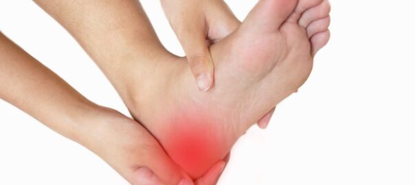 Plantar Fasciitis