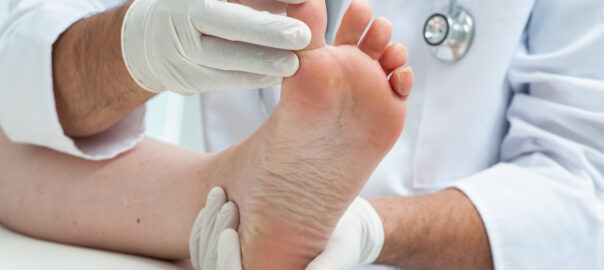 Diabetic foot care