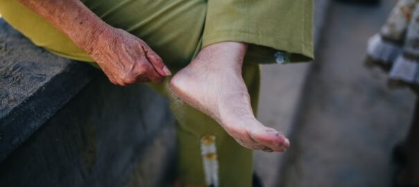 diabetic foot