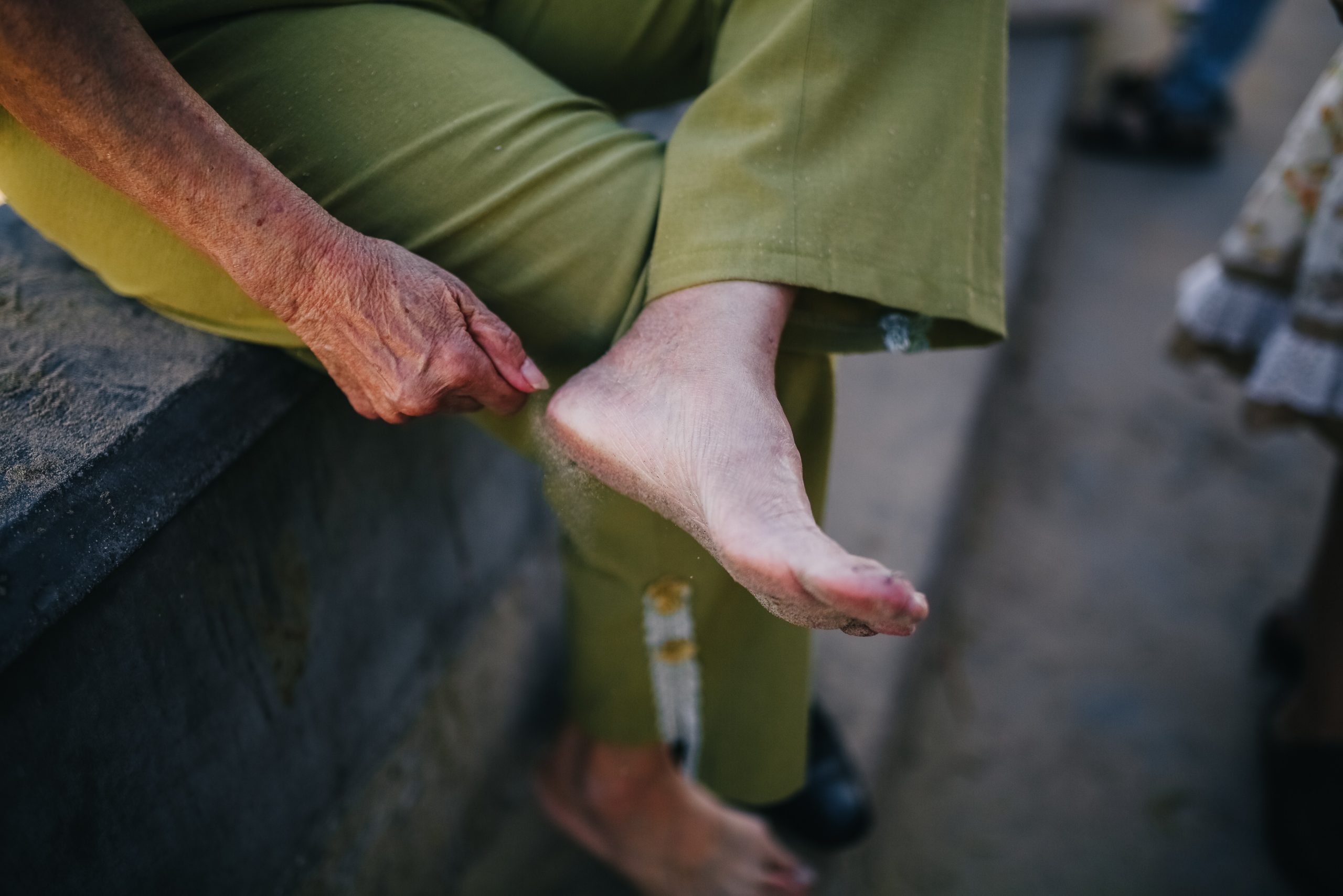 foot arthritis scaled scaled