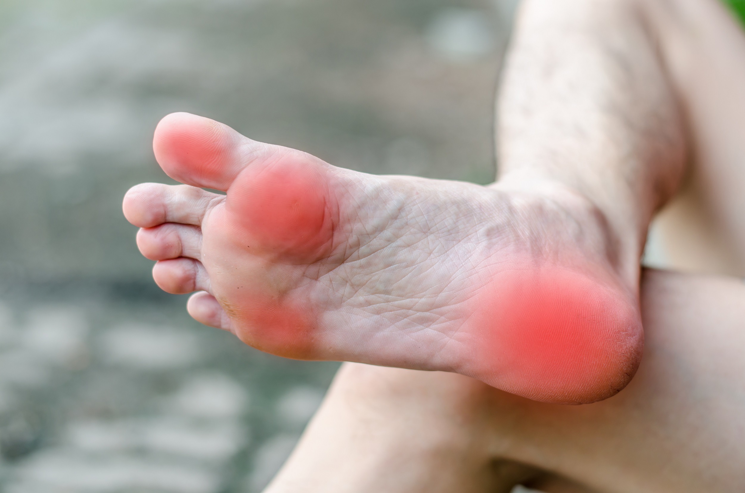 foot pain 1