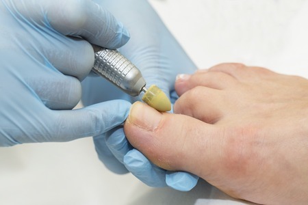 toenal fungus free 3